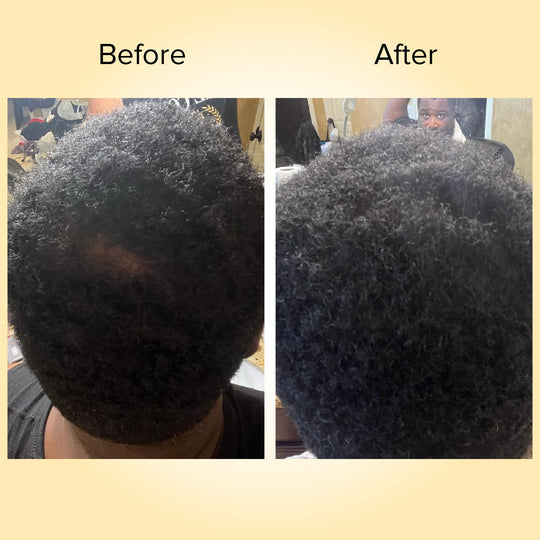 Hair Growth Oil